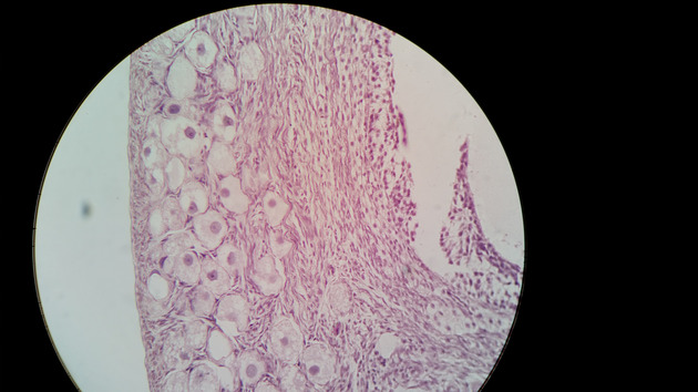 Ovary Follicle Slides - Ovary Follicle 010 400X